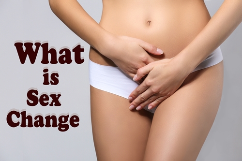 What is Sex change?